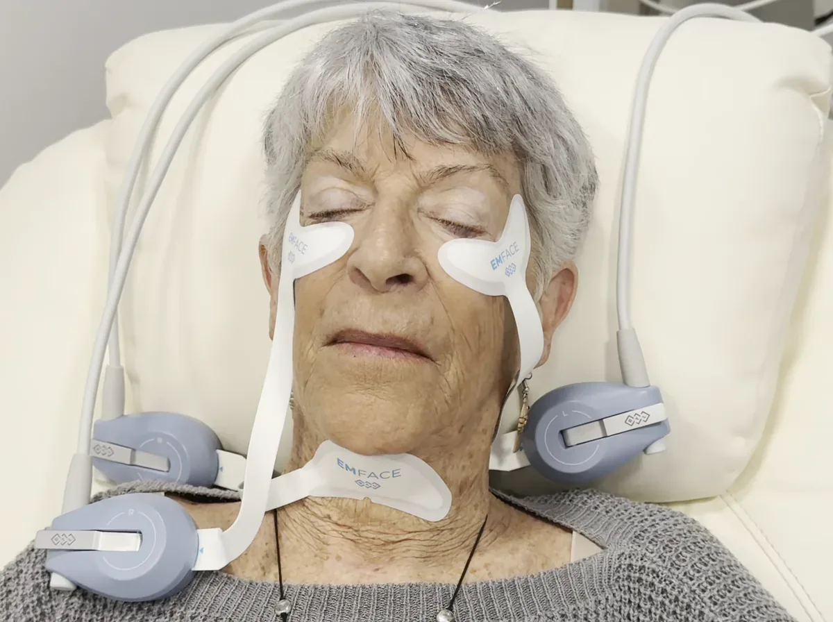 Non-Surgical Facelift