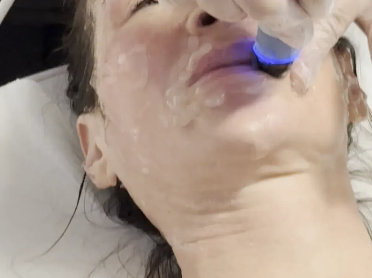 Face and jawline